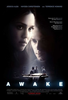 Film Awake - Anestesia cosciente